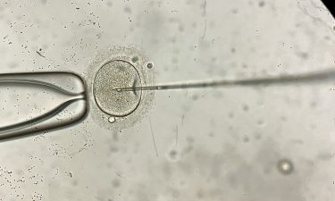 Microscope view of in vitro fertilization in the laboratory.