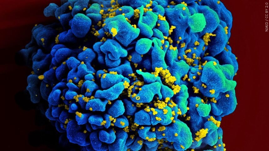 Sonora Quest Laboratories bring HIV awareness