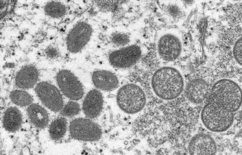 The World Health Organization renames monkeypox as "mpox" on Monday. Pictured is an undated microscopic image of the Monkeypox virus.