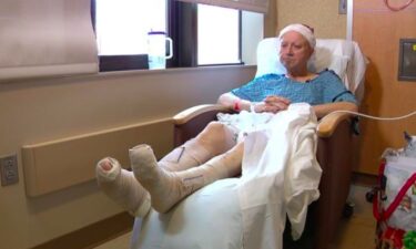 A grandpa recovering from frostbite cautions others about spending time outside during this NEXT Weather Alert. Jeffrey "Papa" Love is being treated in the burn center at Hennepin Healthcare